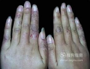 �򵥷��������ֽŶ�������